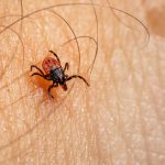 a close up of a bug on a human's skin