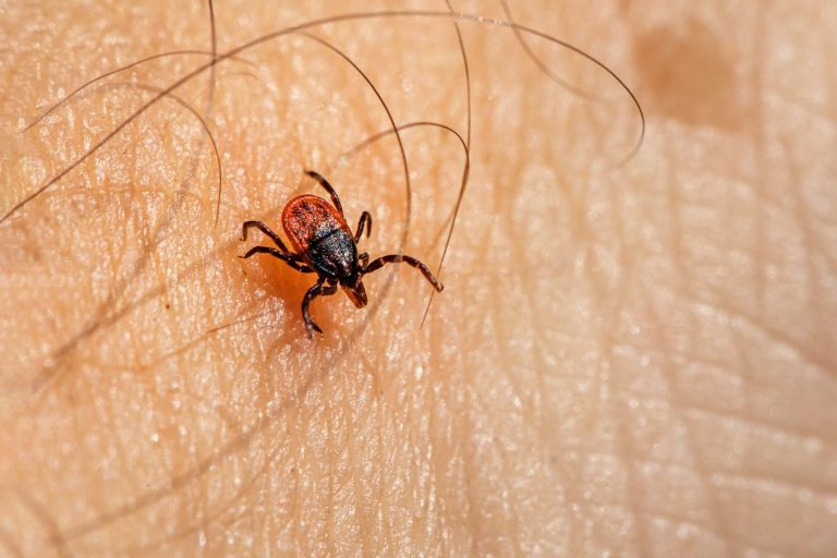 a close up of a bug on a human's skin