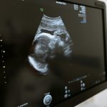 Free stock photo of 3d scanning, 3d ultrasound, analysis